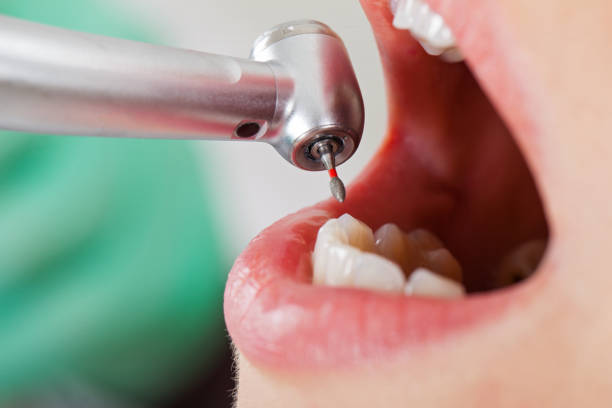 Best Emergency Treatment for Toothache in Colquitt, GA